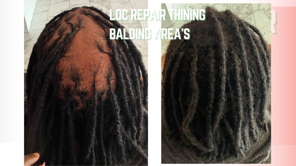 filling in balding areas on locs